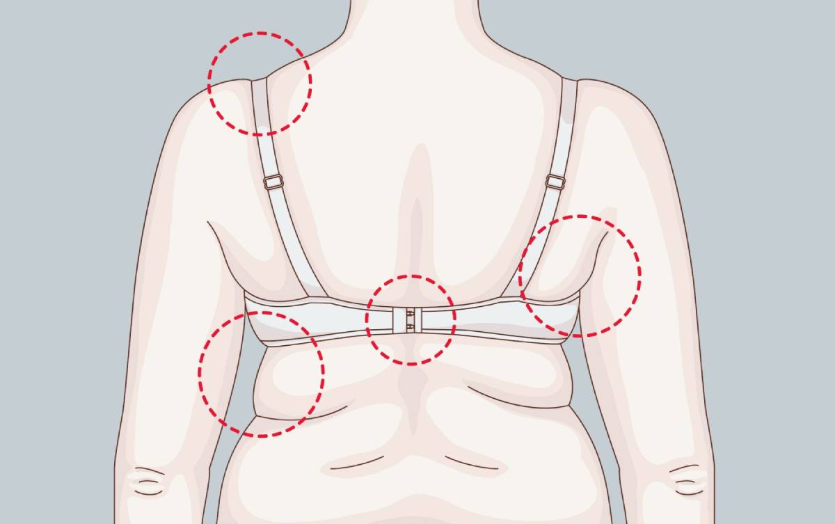 Signs that your bra doesn't fit