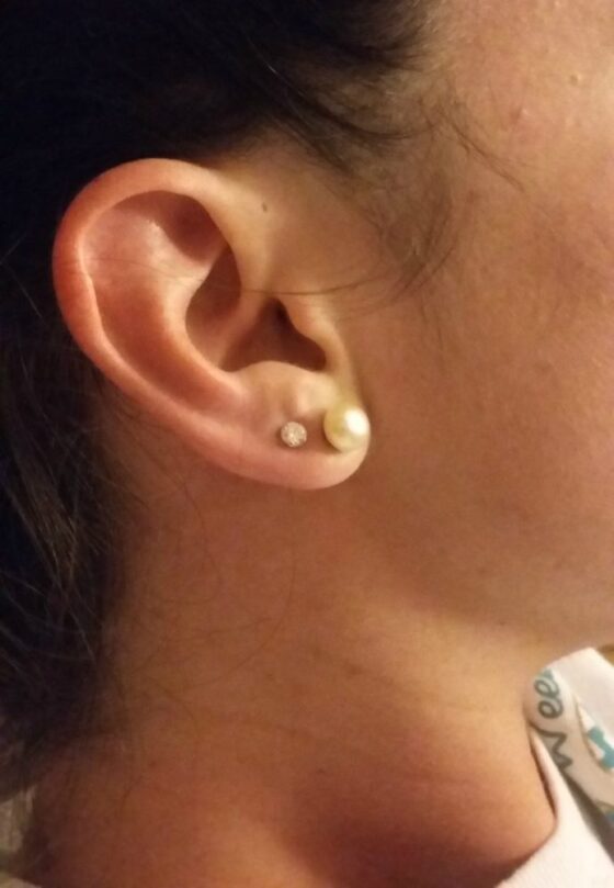 In College And On A Budget I Pierced My Ears Safely At Home Here S How To Pierce Your Ear