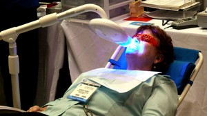laser-tooth-whitening-by-gruntzooki.jpg