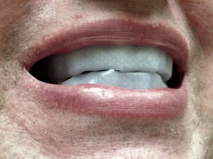 teeth-whitening-strips-by-glindsay65.jpg